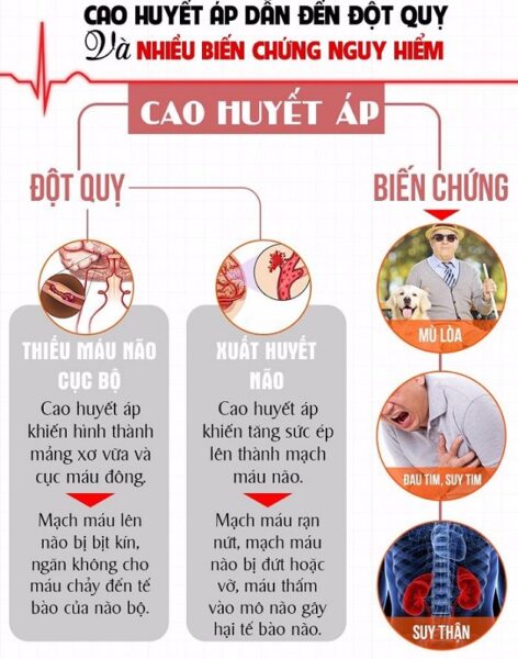 Kiểm soát tốt chỉ số huyết áp để phòng chống đột quỵ