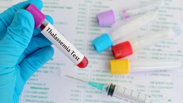 Làm thế nào để phát hiện bệnh thalassemia (tan máu bẩm sinh)?