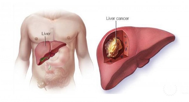 Lợi ích từ việc tiêm phòng vắc xin ngừa viêm gan B