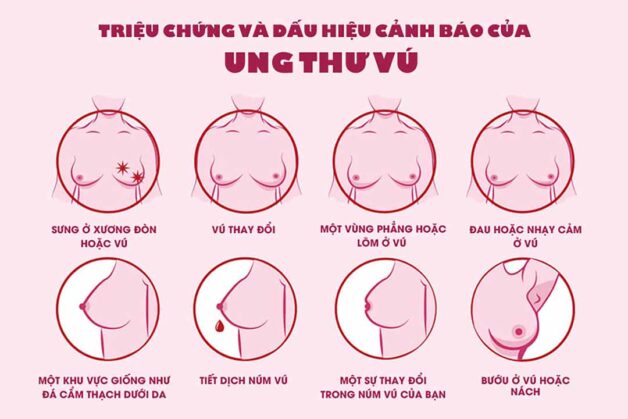 Mách nhỏ chị em những dấu hiệu tầm soát ung thư vú