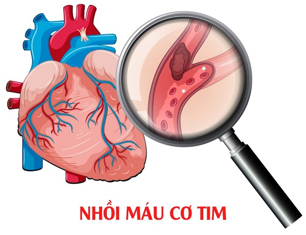 Mất ngủ gây ảo giác, dễ mắc bệnh tâm thần