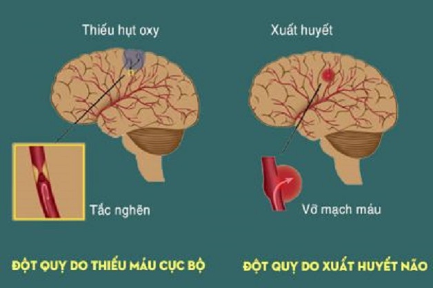 Mất ngủ quá lâu dễ sinh nhiều bệnh tật