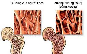 Máy đo loãng xương toàn thân OSTEO pro DEXA