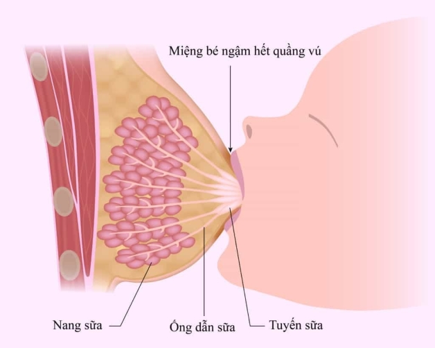 Mẹ sau sinh hay bị tắc tia sữa, phải làm sao?