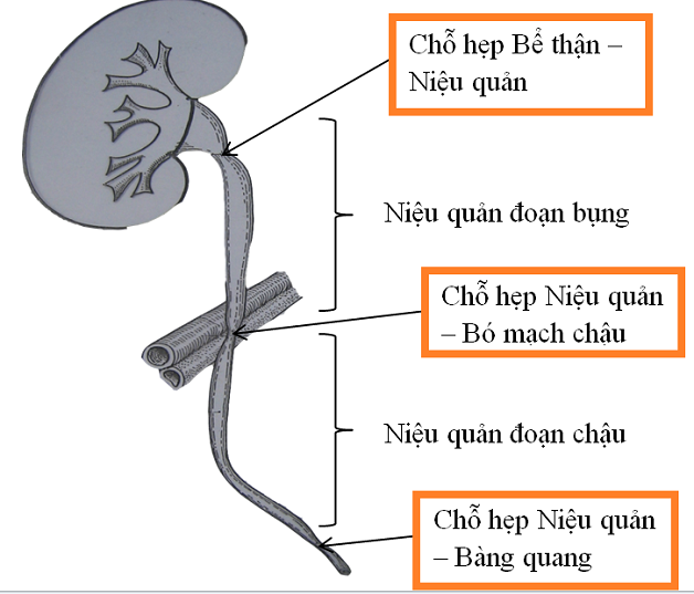 Mổ tạo hình niệu quản và những điều người bệnh cần biết