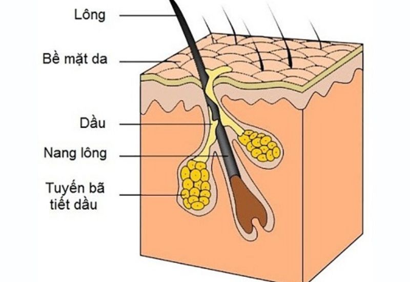 Mổ u bã đậu đúng cách để ngăn chặn khối u tái phát