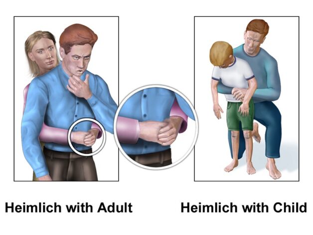 Muôn vàn lời đồn về cách hết hóc xương cá