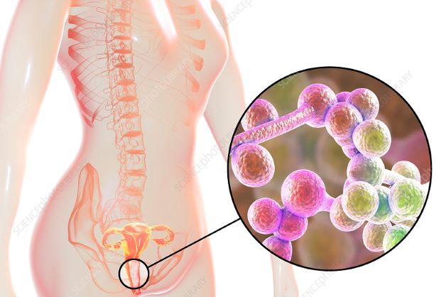 Nấm Candida âm đạo – Nguyên nhân và cách điều trị