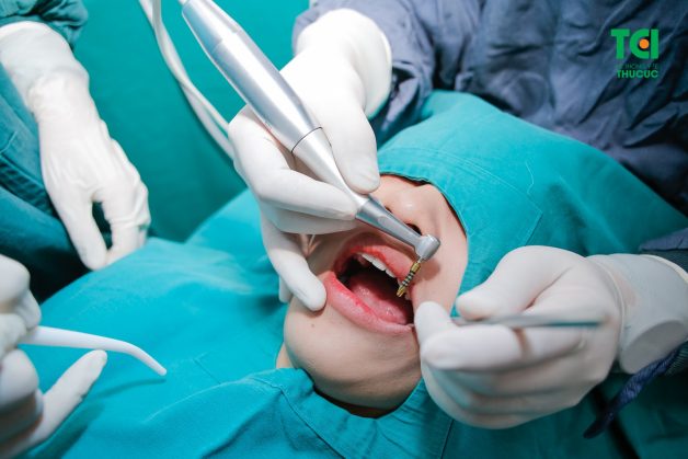 Nên cấy ghép implant ở đâu để đảm bảo an toàn?