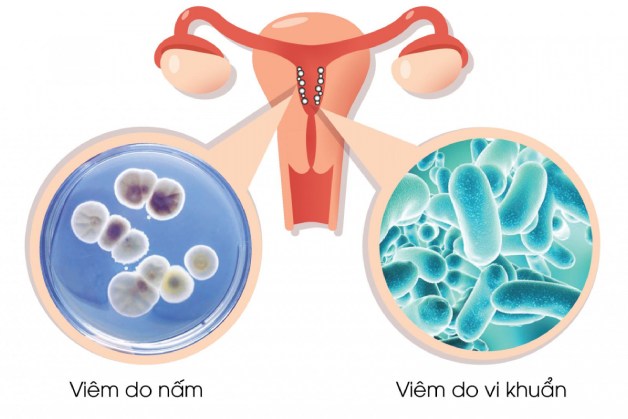 Nên chọn gói khám sàng lọc bệnh lý phụ khoa cơ bản khi nào?