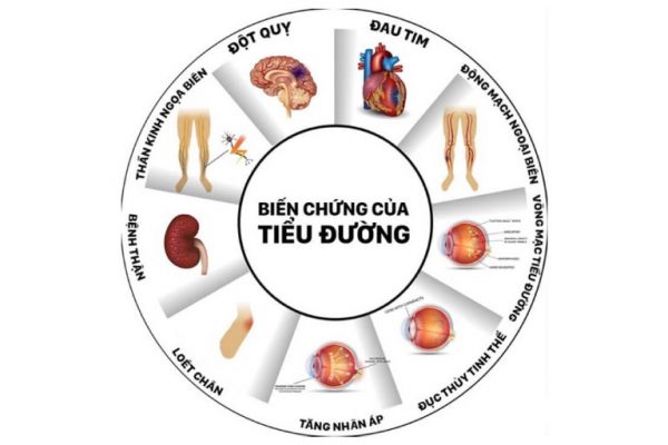 Nguyên nhân gây ra bệnh tiểu đường là gì?