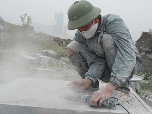 Nguyên nhân gây ung thư mắt và cách phòng ngừa hiệu quả