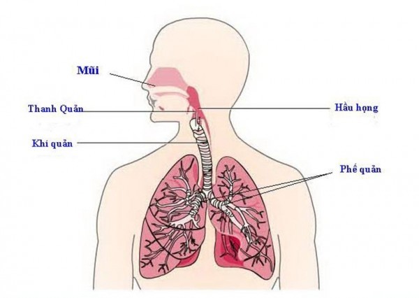 Nguyên nhân gây viêm đường hô hấp