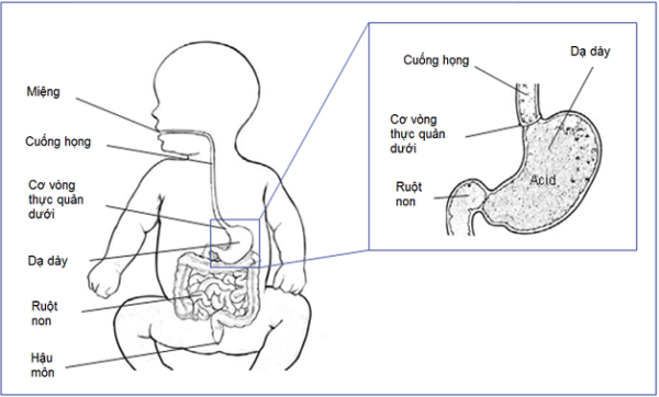 Nguyên nhân rối loạn tiêu hóa ở trẻ sơ sinh