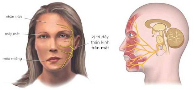 Nguyên nhân, triệu chứng của bệnh viêm dây thần kinh số 7