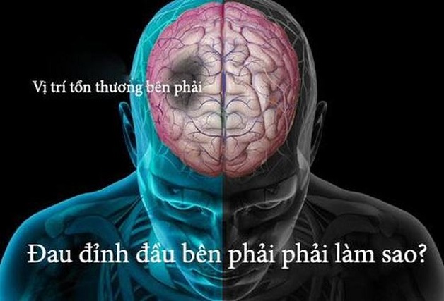 Nguyên nhân và cách khắc phục chứng đau đỉnh đầu