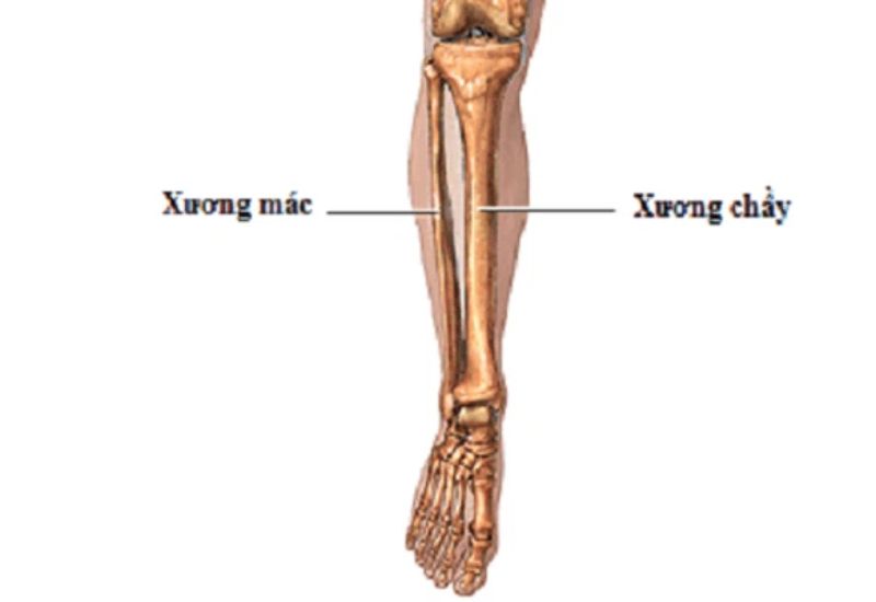 Nhận biết sớm các dấu hiệu gãy xương mác để điều trị kịp thời