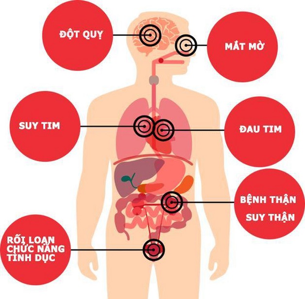 Nhận biết tăng huyết áp sớm để điều trị hiệu quả