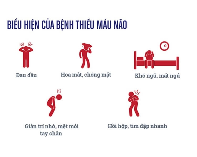 Nhận biết triệu chứng thiếu máu não cùng cách phòng ngừa và điều trị