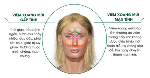 Nhận biết và điều trị viêm xoang mãn tính