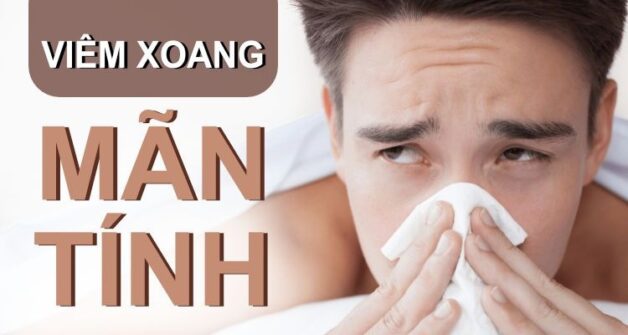 Nhận biết và thực hiện đúng cách điều trị viêm xoang mãn tính