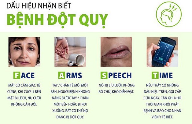 Nhận diện sớm triệu chứng tai biến mạch máu não 