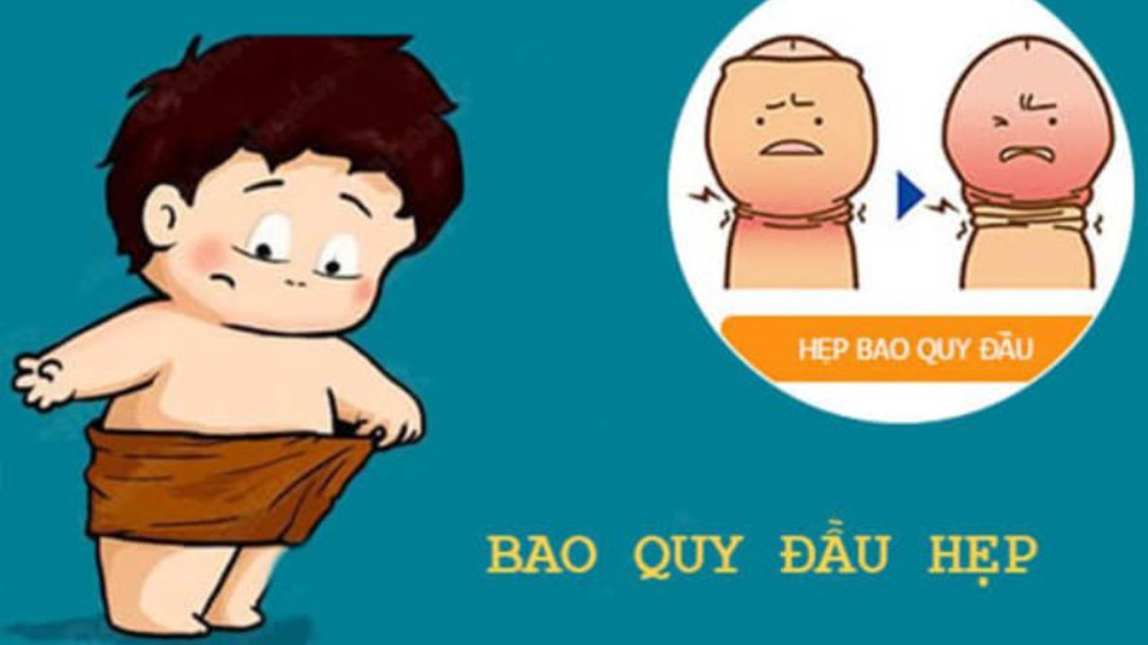 Nhận diện và xử trí hẹp bao quy đầu, giúp nam giới lấy lại tự tin