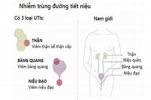 Nhiễm trùng đường tiểu có nguy hiểm không?