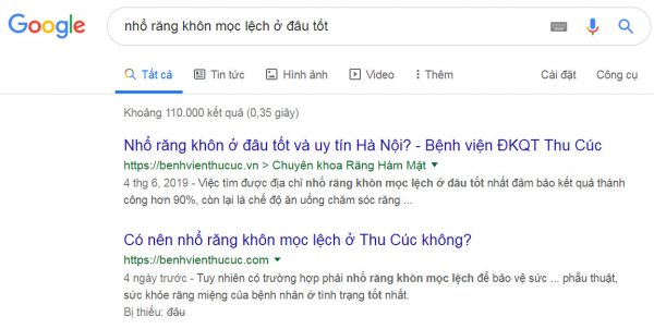 Nhổ răng khôn mọc lệch ở đâu tốt? Mách bạn 3 bước