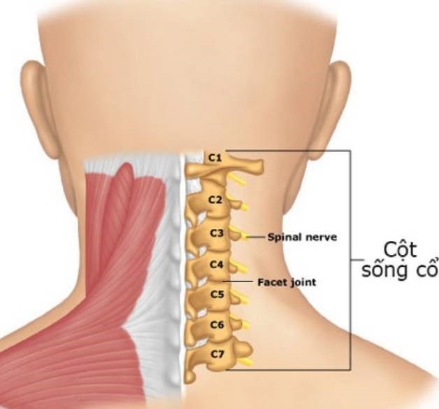 Những cách chữa thoái hóa đốt sống cổ không phải phẫu thuật