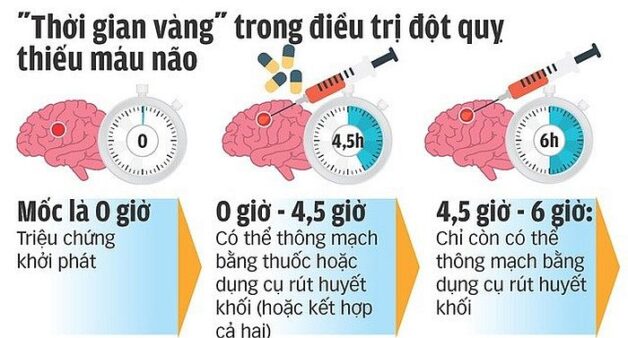 Những cách khắc phục đột quỵ bạn cần biết