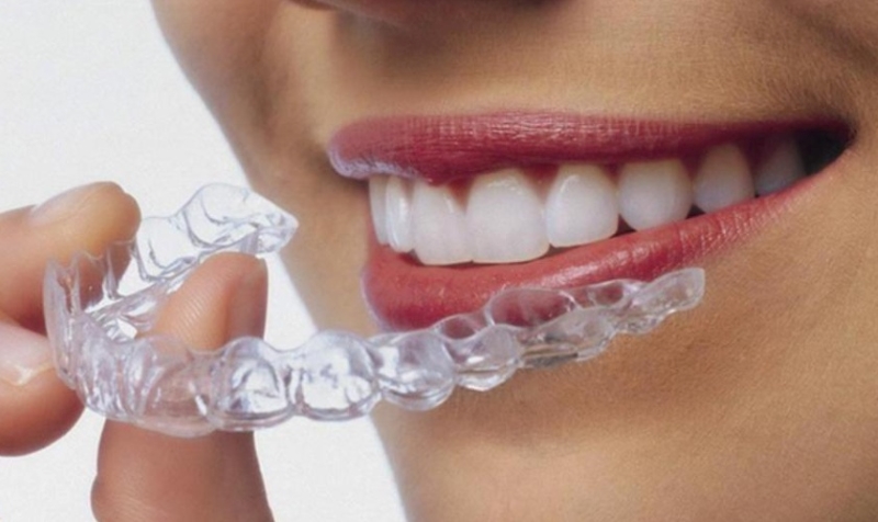 Những điểm khác nhau giữa niềng răng 3D Clear và Invisalign