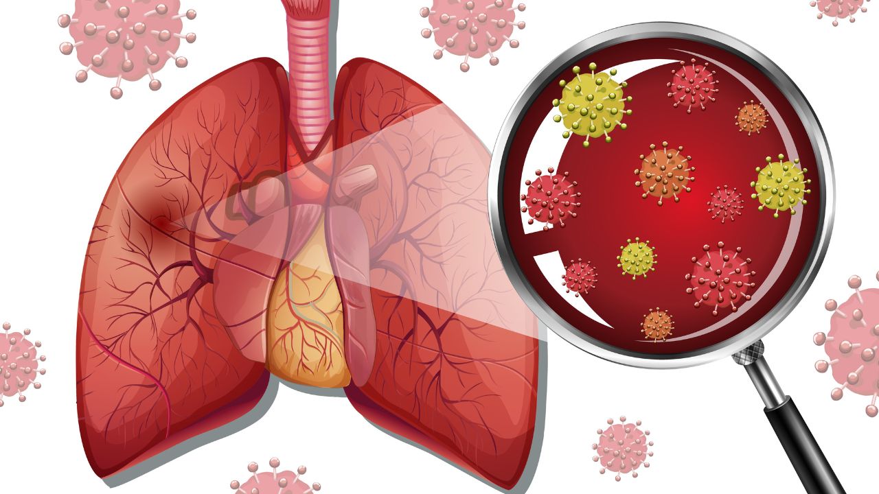 Những điều cần biết về bệnh viêm phổi kẽ