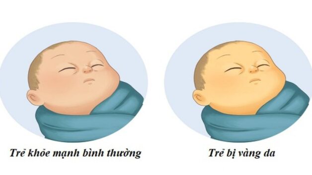 Những điều cần biết về nang tuyến thượng thận