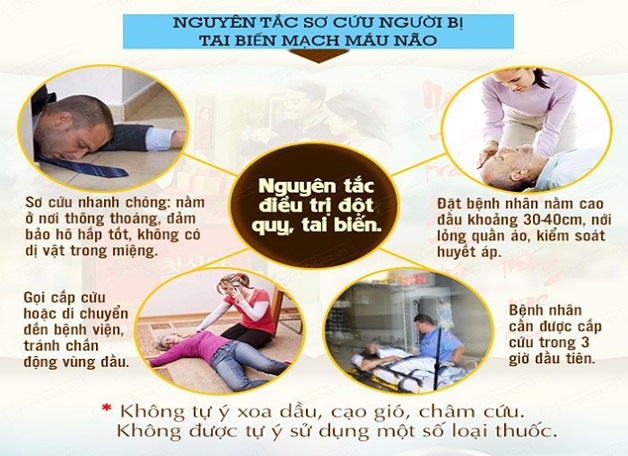 Những điều cần biết về tai biến mạch máu não để phòng tránh hiệu quả