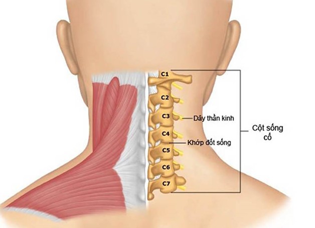 Những điều cần biết về thoái hóa cột sống cổ và cách điều trị