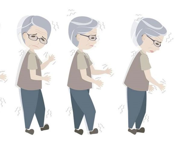 Những điều có thể bạn chưa biết về bệnh parkinson người già