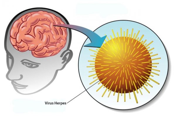 Những hiểu lầm về mụn rộp sinh dục (bệnh herpes sinh dục)