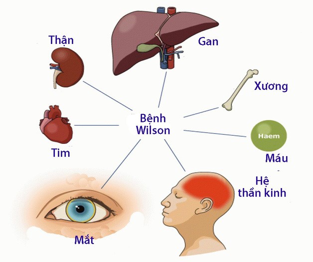 Những kiến thức cần biết về bệnh rối loạn vận động