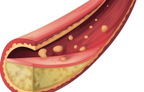 Những loại rau và trái cây giúp làm giảm cholesterol