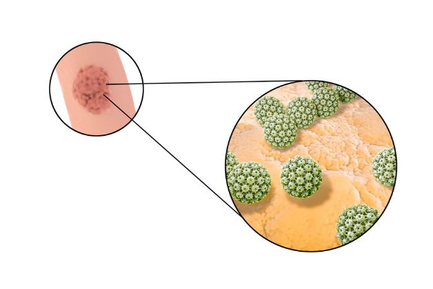 Những lý do nam giới cần tiêm phòng HPV càng sớm càng tốt