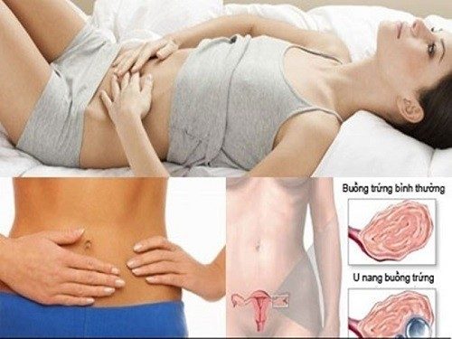 Những nguyên nhân gây đau bụng dưới