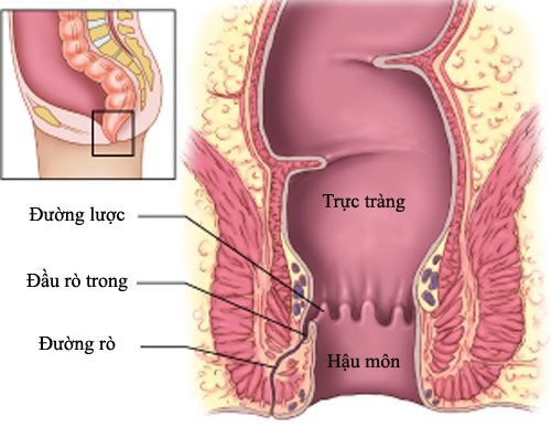 Những nguyên nhân gây đi ngoài ra máu và chất nhầy