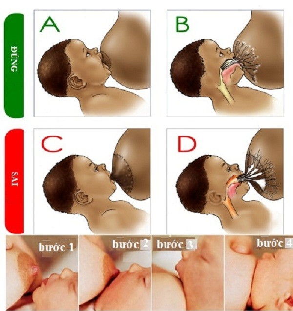 Những nguyên nhân làm mẹ ít sữa, mất sữa