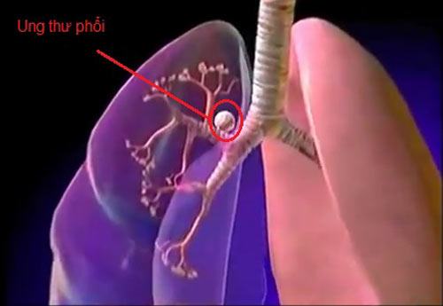 Những sự thật thú vị về phổi, bạn đã biết chưa?