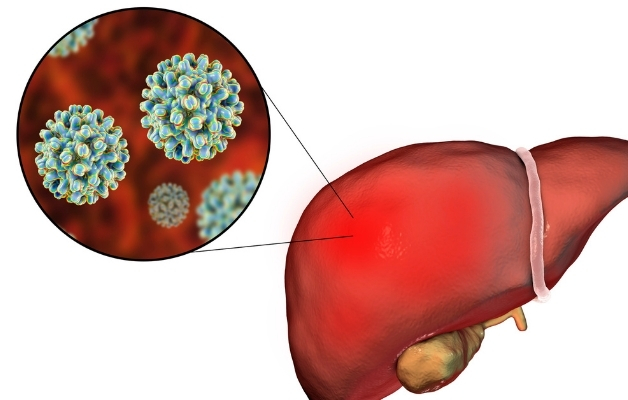 Những thông tin bạn cần biết về viêm gan cấp tính