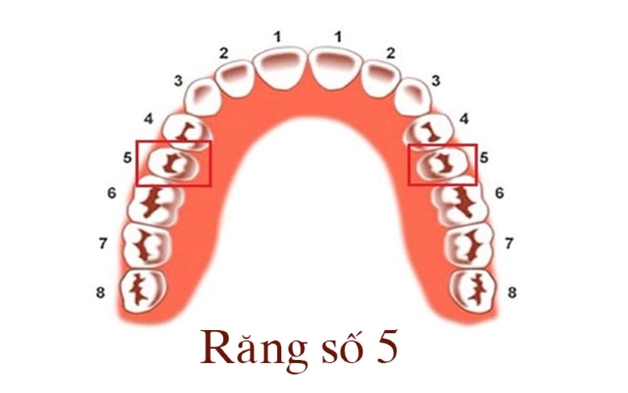 Những vấn đề khi nhổ răng số 5