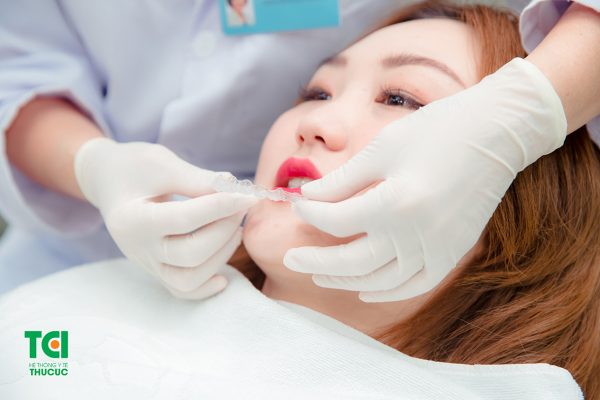 Niềng răng invisalign có ưu điểm gì so với phương pháp khác?