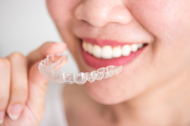 Niềng răng invisalign đặc biệt tại các nước phát triển