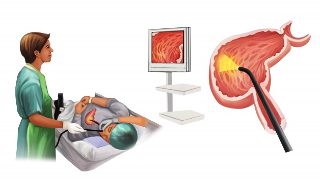Nội soi dạ dày đại tràng ở đâu tốt nhất hiện nay?
